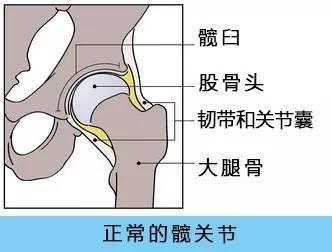 骨密度检查仪人身体出现哪些情况需要做髋关节置换术