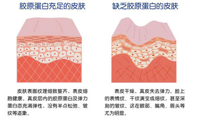 骨密度仪