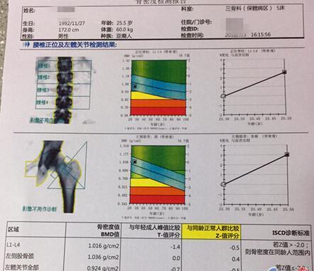 骨密度仪价格重要吗？不想骨骼脆弱医生教你看懂骨密度报告