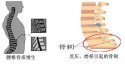 骨密度仪的专业厂家阐述骨质增生与骨质疏松,仪器专业检测骨密度正常值