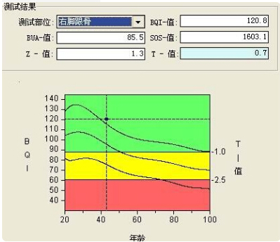 骨密度仪的专业厂家阐述骨质增生与骨质疏松,仪器专业检测骨密度正常值