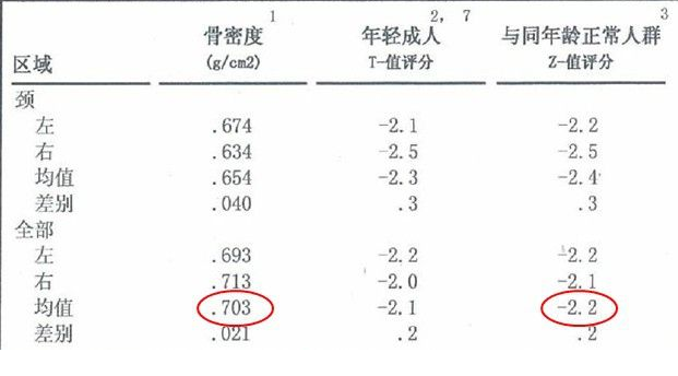 骨密度仪生产厂家根据T值和Z值的变化来判断骨骼健康的状况 骨密度仪生产厂家根据T值和Z值的变化来判断骨骼健康的状况