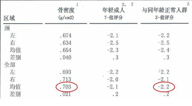 骨密度仪生产厂家根据T值和Z值的变化来判断骨骼健康的状况