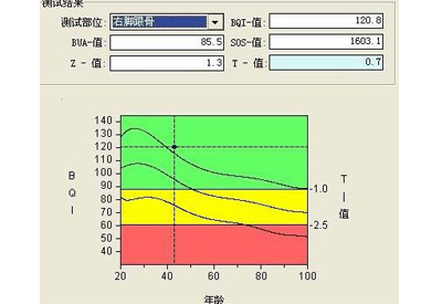 深度解析骨密度t值和z值你所不知道秘密报告单中最重要的两个指标