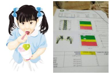 儿童超声骨密度测量仪小儿测骨密度没有你想象的那么不靠谱