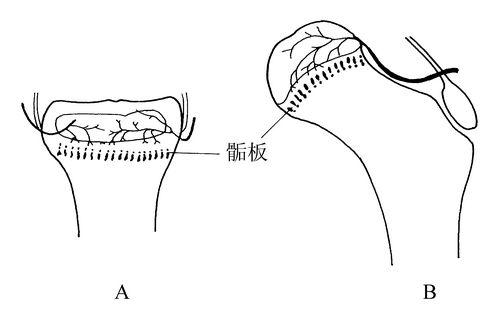 骨密度测试仪生产厂家骨骺生长停止后还能修复吗？