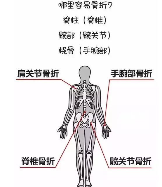 骨密度检测仪