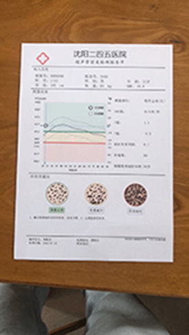 超声波骨密度仪品牌妇保院新增儿童（成人）骨密度检查业务