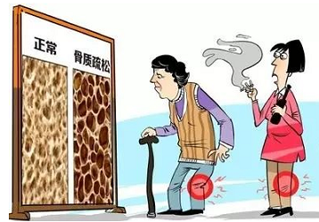 医院体检科选用超声波骨密度仪桡骨准确吗？超声波测试仪怎么操作