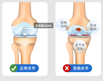 国康超声骨密度仪厂家不管是青年还是老人都需要的骨密度