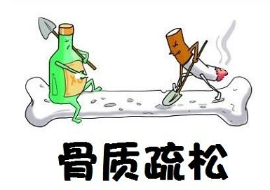 骨密度检测仪厂家排名-更容易出现骨质疏松的人群