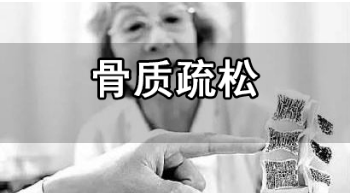 医用超声骨密度检测仪厂家 超声骨密度检测仪厂家