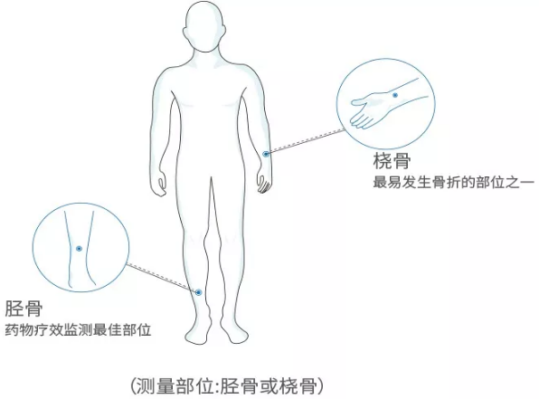 超声波骨密度分析仪厂家 国产老年人超声波骨密度分析仪厂家